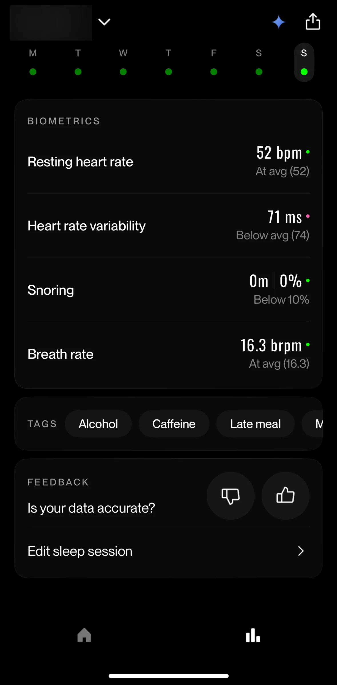 Eight Sleep Screen screen in the Editing a sleep session flow